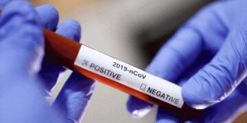 جموں کشمیر میں کوروناکے108نئے مثبت معاملات سامنے آئے