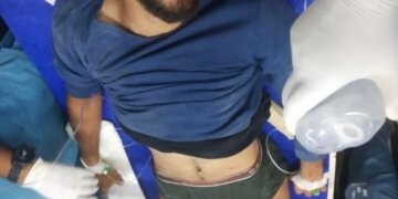 آزاد گنج بارہمولہ میں شہری پُر اسر ار طور پر گولی لگنے سے زخمی