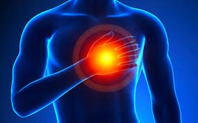 سینے میں جلن (Heartburn) کیا ہے