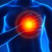 سینے میں جلن (Heartburn) کیا ہے