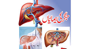 مصنوعی ذہانت کے ذریعے ابتدائی مراحل میں جگر کی بیماری کی تشخیص ممکن